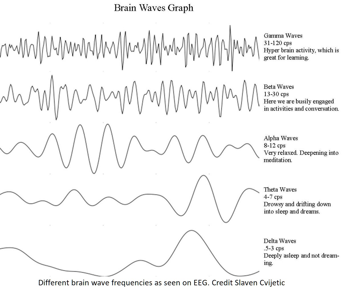 Brain wave patterns