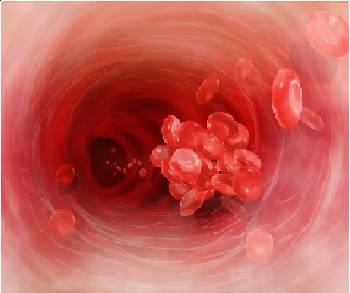 clumped blood platelets traveling through heart artery