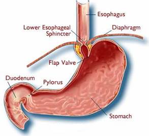 lower esophageal sphincter at bottom of esophagus