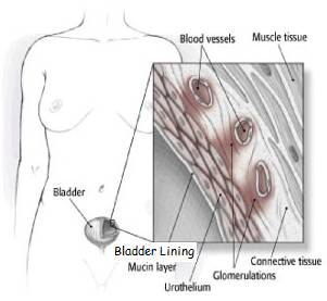 location of bladder and zoom of bladder lining