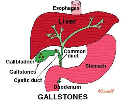 location of gallbladder and gallstones